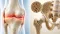 Osteoartróza vs. osteoporóza: rozdiel medzi kĺbmi a kosťami