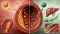 Cholesterol: co znamená LDL, HDL, triglyceridy a celkový cholesterol